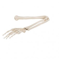 Bone of Arm and Hand